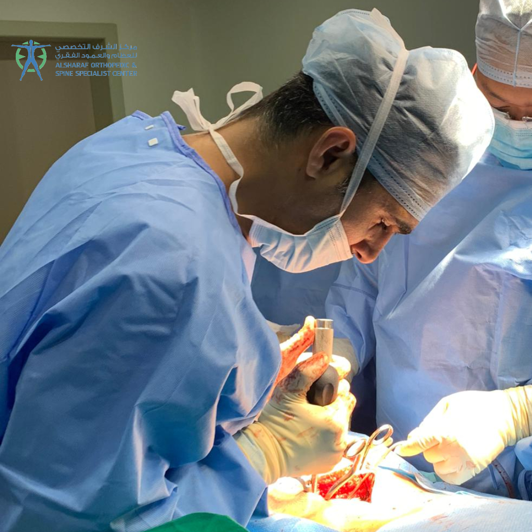 A precise moment in the operating room, where Dr. Yousif Sharaf dedicates his expertise and effort to restore the patient’s health.